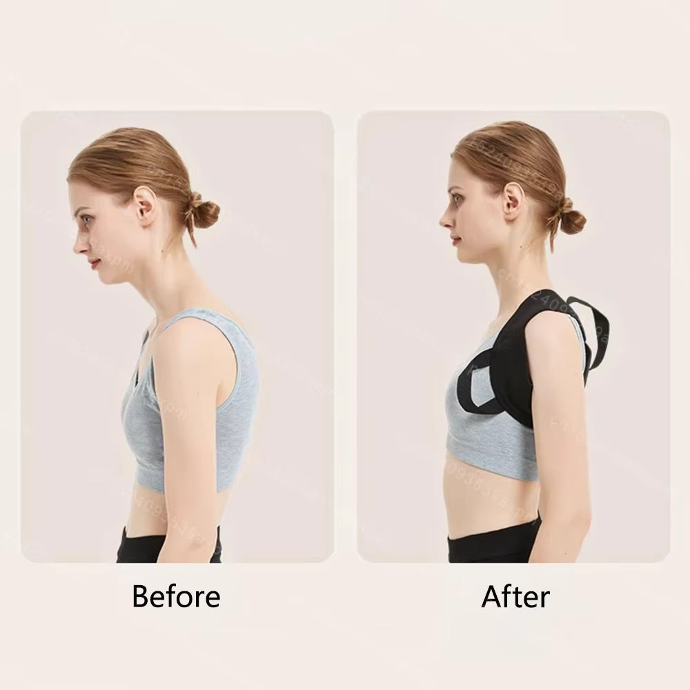 StandSure— Posture Corrector